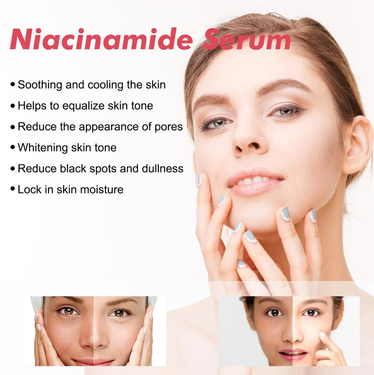 Niacinamide Whitening Freckles Serum Removal Melasma Dark Spots Lighten Melanin Pigmentation Brightening Anti-Aging Beauty Care