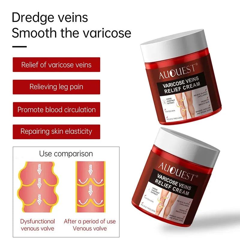 AUQUEST Varicose Veins Relief Cream Vasculitis Phlebitis Spider Pain Relief Ointment Medical Plaster Body Care 80g