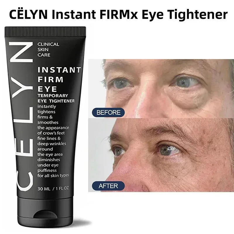 Cëlyn 3 Minutes Instant Firm Eye Cream Wrinkle Removal Lifting Tighten Remove Eye Bags Dark Circles Moisturize Peptide Eye Cream