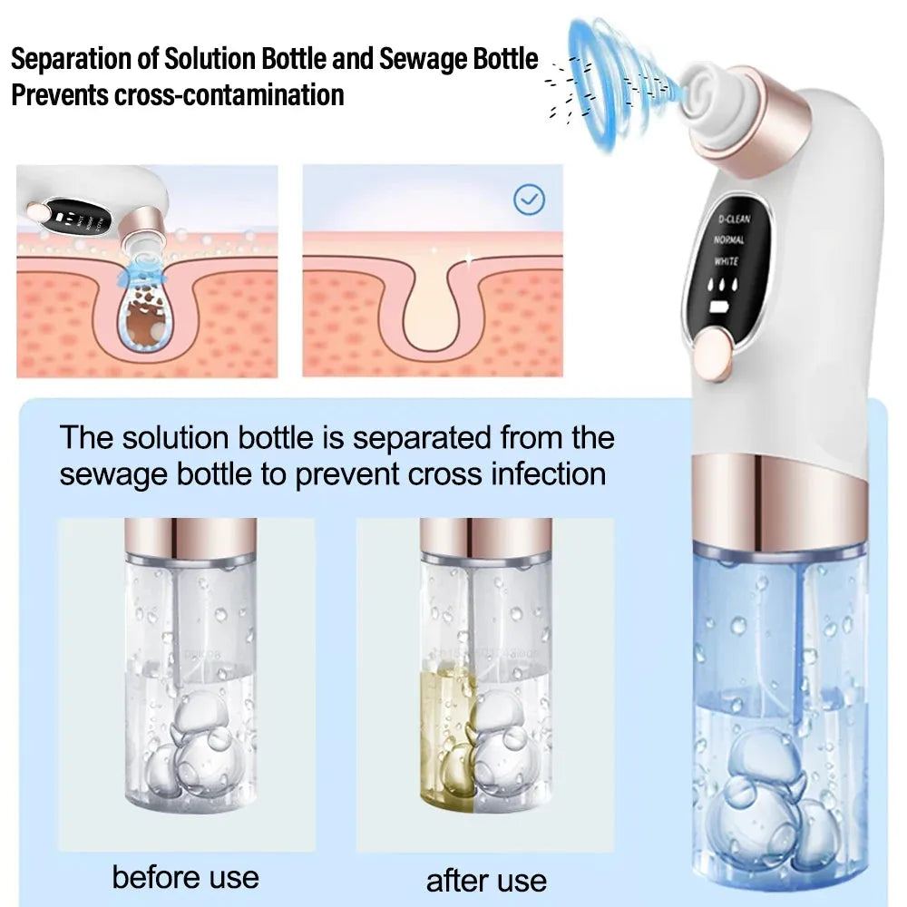 Electric Blackhead Remover Vacuum Bubble Water Cycle Face Hydro Dead Skin Beauty Acne Cleaner Pore Suction Vacuum Removal Device