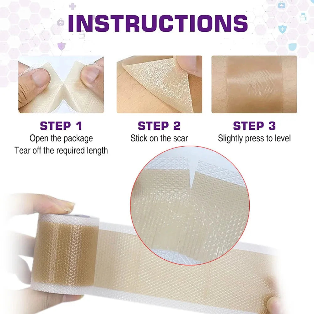 1Roll Silicone Scars Sheets Keloid Bump Removal Strips,Scars Reducing Treatments Surgical Scars, Burn,Tummy Tucks, C-Section