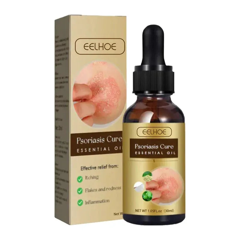 Psoriasis essential oil skin moss repair Hand Foot Dermatitis Eczema Antibacterial Anti Itching swelling relief Rash Care Serum