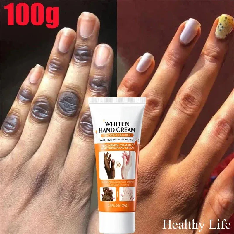 2024 Dark Knuckles Fast Whitening Serum Anti Cracking Cream Pigmentation Correctors For Black Skin Fast Stains Remover Products