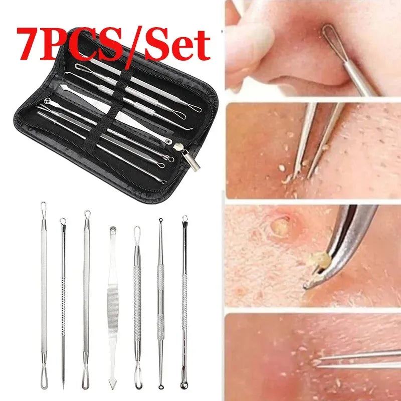 7/8Pcs Stainless Steel Blackhead Remover Tool Set Whitehead Pimple Spot Comedone Acne Extractor Remover Popper Face Tools Kit