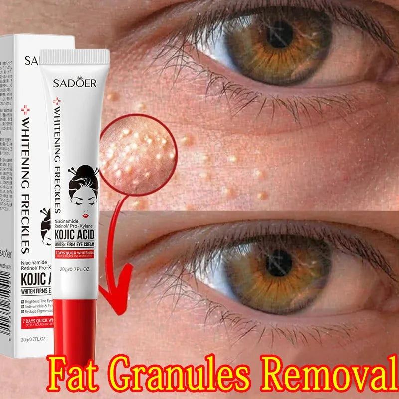 Fat Granules Remover Eye Cream Anti-Puffiness Firm Cream Anti Inflammatory Fade Fine Line Repair Skin Barrier Korean Skin Care