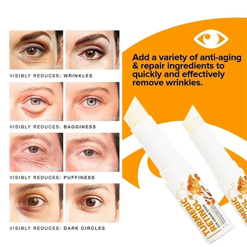 Turmeric Eye Cream Stick Remove Dark Circles Fat Brightening Eyes Anti-Puffiness Lift Firming Fine Lines Eye Care