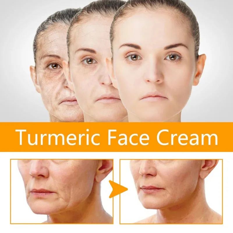 50g Turmeric Face Cream Remove Dark Spots Whitening Shrink pores Vitamin C Moisturizing Anti-Aging Firming Skin Care