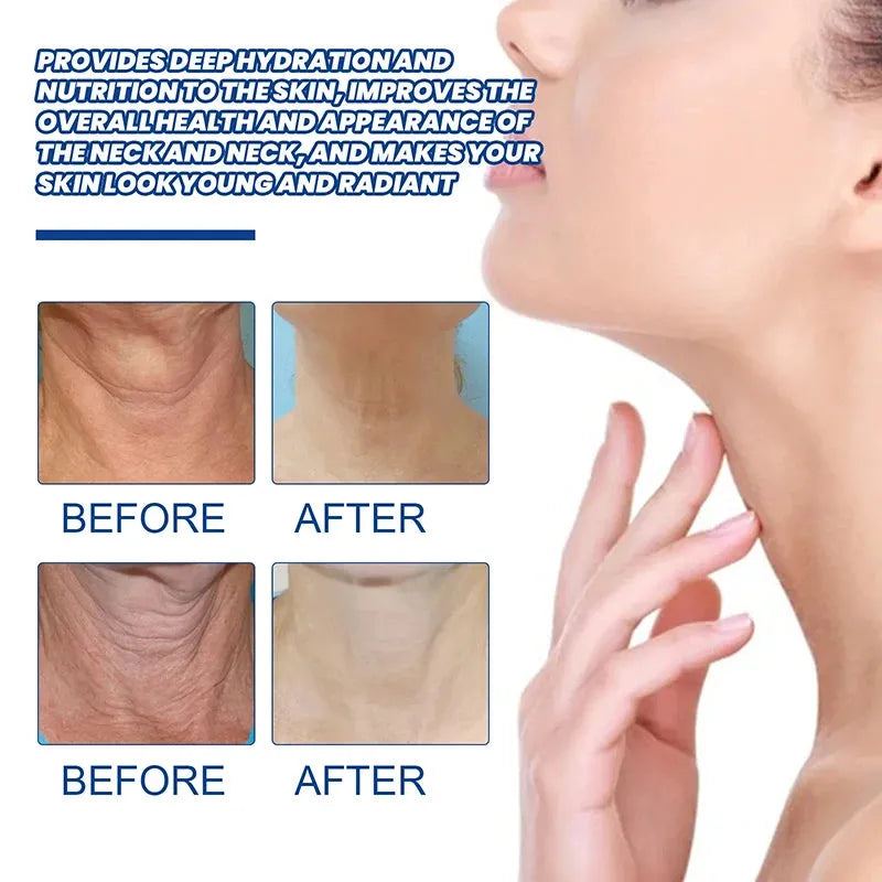 Neck Lines Protein Cream Lift Neck Eliminate Neck Fine Lines Anti-ageing Eliminate Double Chin Moisturis Nourish Rejuvenation