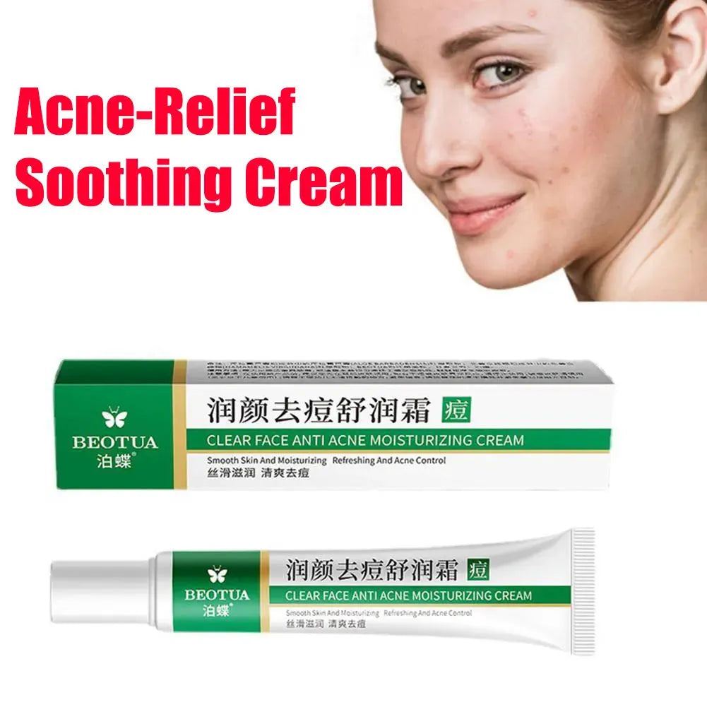 Herbal Acne Face Cream Pimple Scar Removal Gel Oil Control Shrink Pore Smooth Acne Marks Facial Cream Skin Care Product