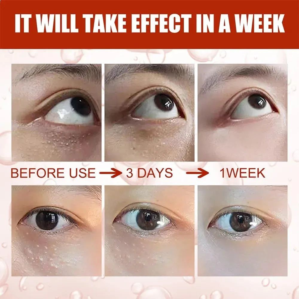 Fat Granules Remover Eye Cream Anti-Puffiness Firm Cream Anti Inflammatory Fade Fine Line Repair Skin Barrier Korean Skin Care