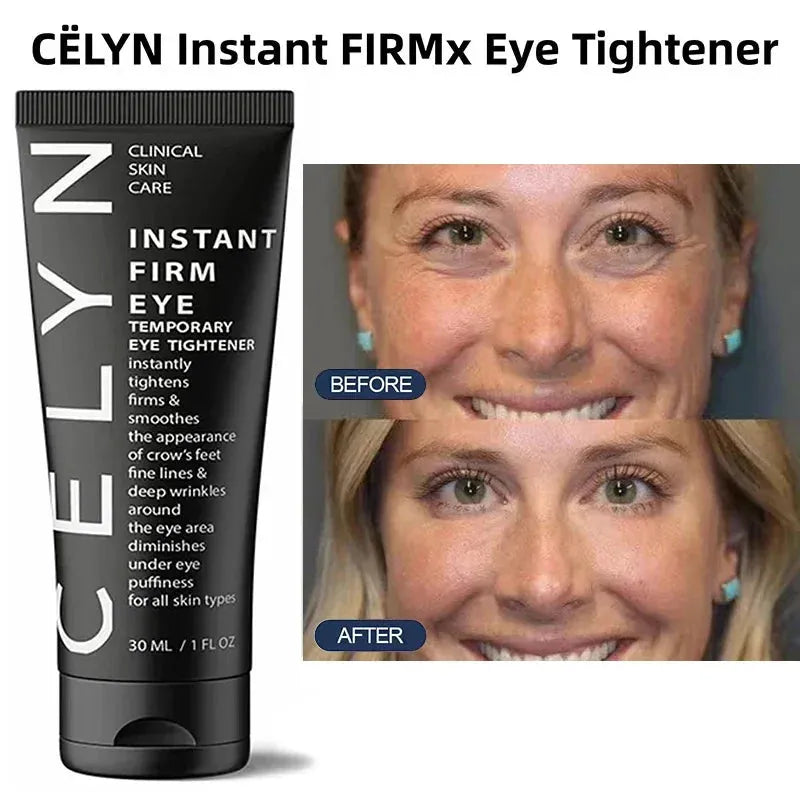 Cëlyn 3 Minutes Instant Firm Eye Cream Wrinkle Removal Lifting Tighten Remove Eye Bags Dark Circles Moisturize Peptide Eye Cream