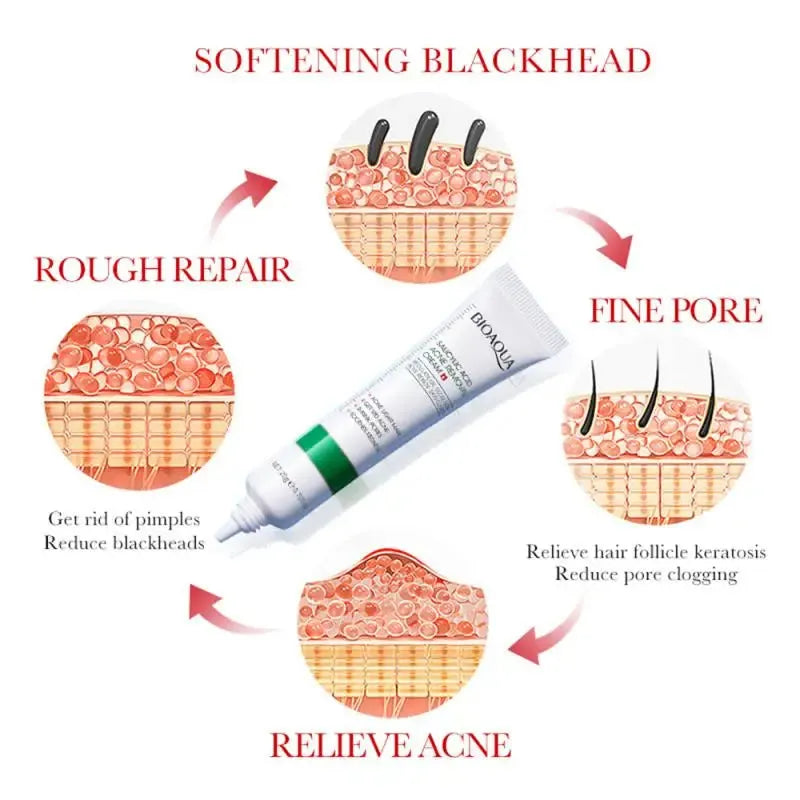 1~10PCS 20ml Salicylic Acid Refining Cream Shrink Pore Improve Acnes Blackheads Whitening Anti-aging Oil Control Skin Care