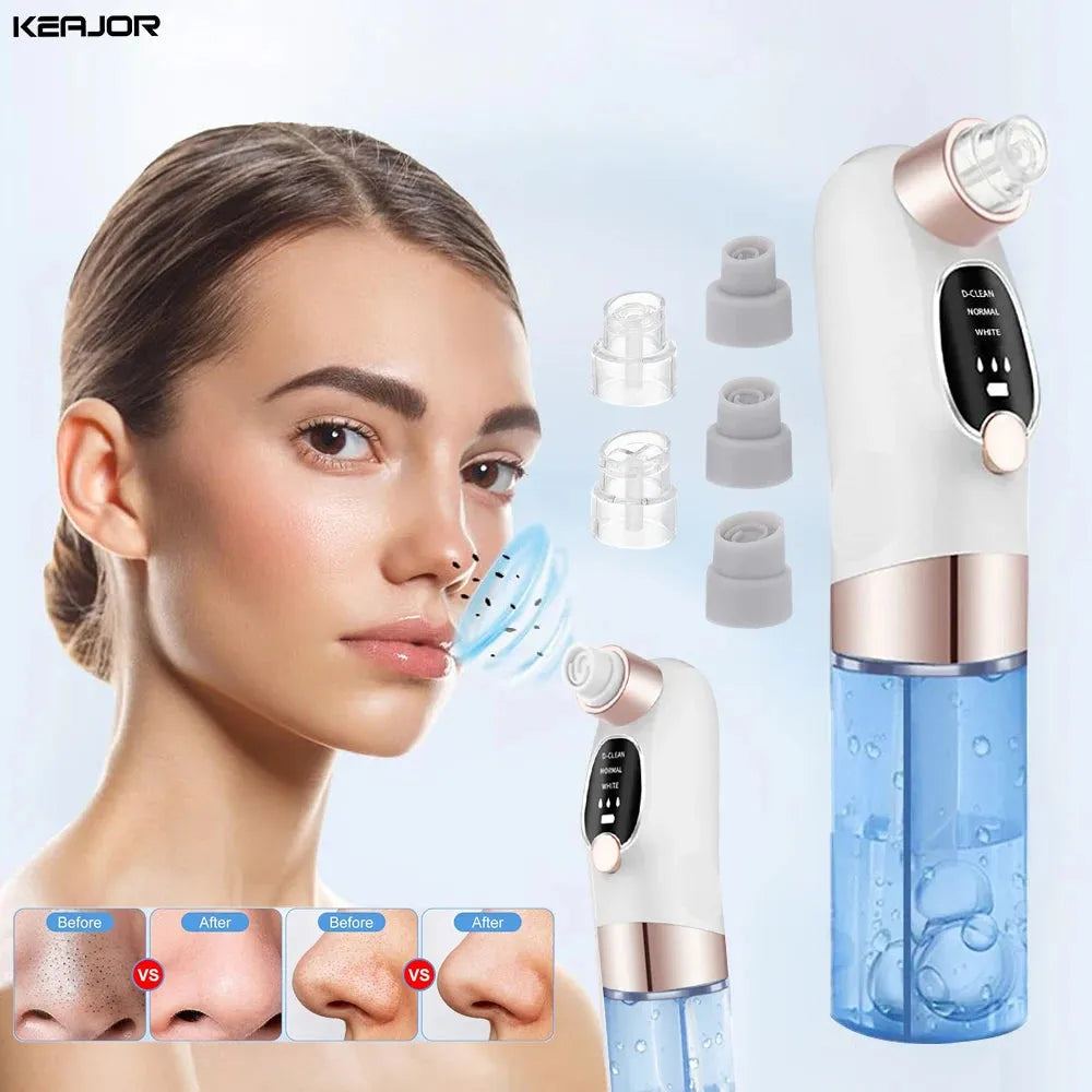 Electric Blackhead Remover Vacuum Bubble Water Cycle Face Hydro Dead Skin Beauty Acne Cleaner Pore Suction Vacuum Removal Device