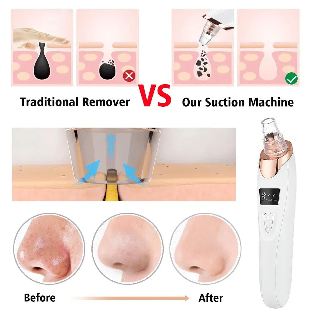 Electric Blackhead Remover Vacuum Acne Cleaner Black Spots Removal Facial Deep Cleansing Pore Cleaner Machine for Skin Care Tool