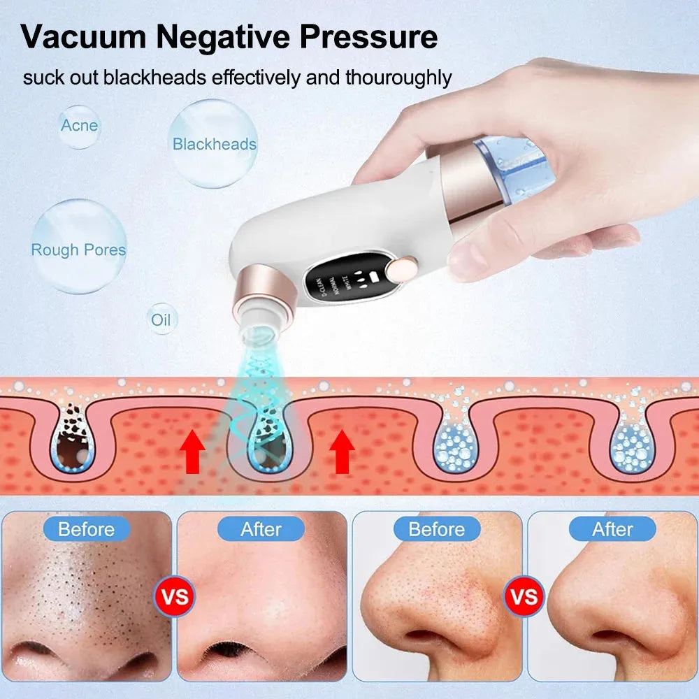 Electric Blackhead Remover Pore Vacuum Cleaner Facial Black Dots Vacuum Cleaner Pimple Acne Blackhead Removal Black Dots Remover