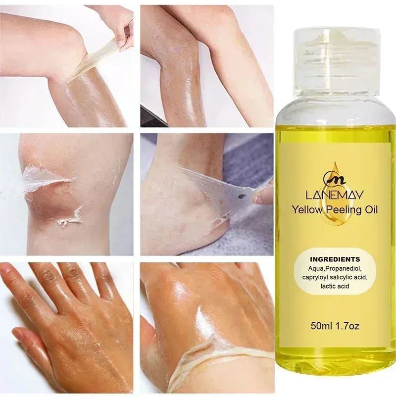 Yellow Peeling Oil Exfoliating Bleaching Dark Skin Spots Knee Finger Remove Dead Skin Melanin Whitening Brighten Body Skin Care