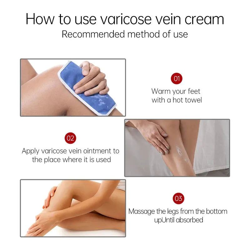 AUQUEST Varicose Veins Relief Cream Vasculitis Phlebitis Spider Pain Relief Ointment Medical Plaster Body Care 80g