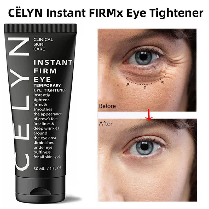 Cëlyn 3 Minutes Instant Firm Eye Cream Wrinkle Removal Lifting Tighten Remove Eye Bags Dark Circles Moisturize Peptide Eye Cream