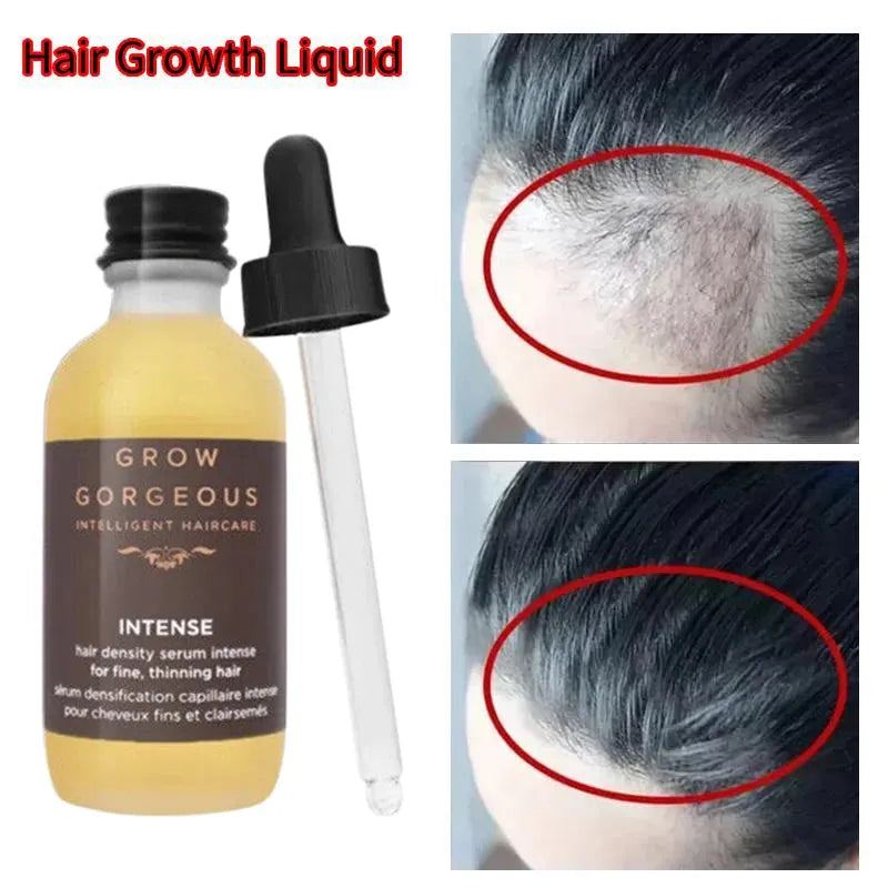 Original Density Hair Growth Serum Intense Cure Thinning Hair and Hair Loss Cruelty Free Hair Growth Serum Hair Care Product