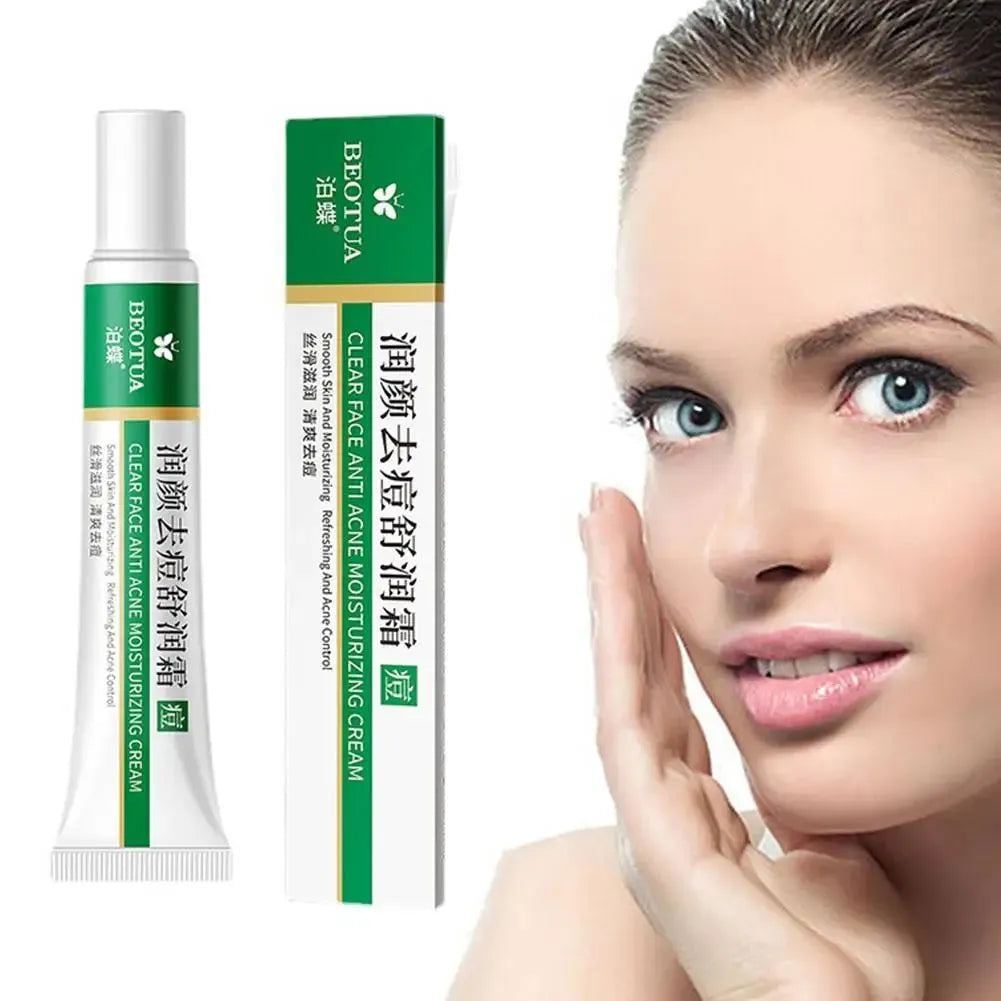 Herbal Acne Face Cream Pimple Scar Removal Gel Oil Control Shrink Pore Smooth Acne Marks Facial Cream Skin Care Product