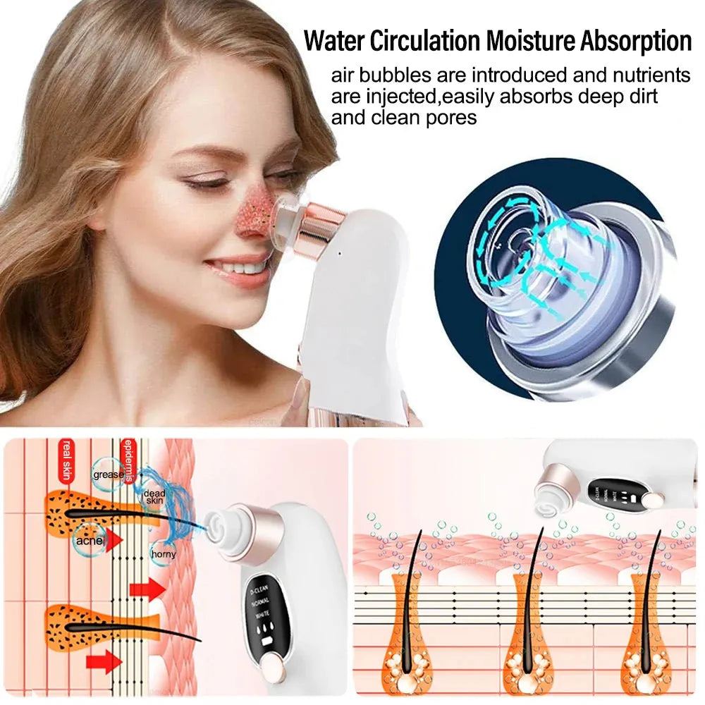 Electric Blackhead Remover Vacuum Bubble Water Cycle Face Hydro Dead Skin Beauty Acne Cleaner Pore Suction Vacuum Removal Device