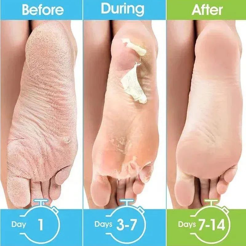 1 Pag = 1 Pair Honey Foot Mask For Remove Dead Skin Calluses Exfoliating Foot Mask Feet Cream Whitening Foot Spa Skin Care Tool