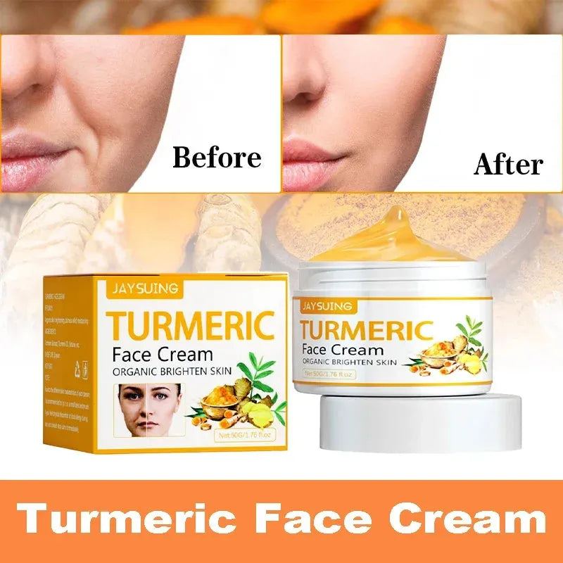 50g Turmeric Face Creams Skin Whitening Cream Anti-oxidation Anti-aging Wrinkle Dark Spots Removal  Acne Treatment Skin Care