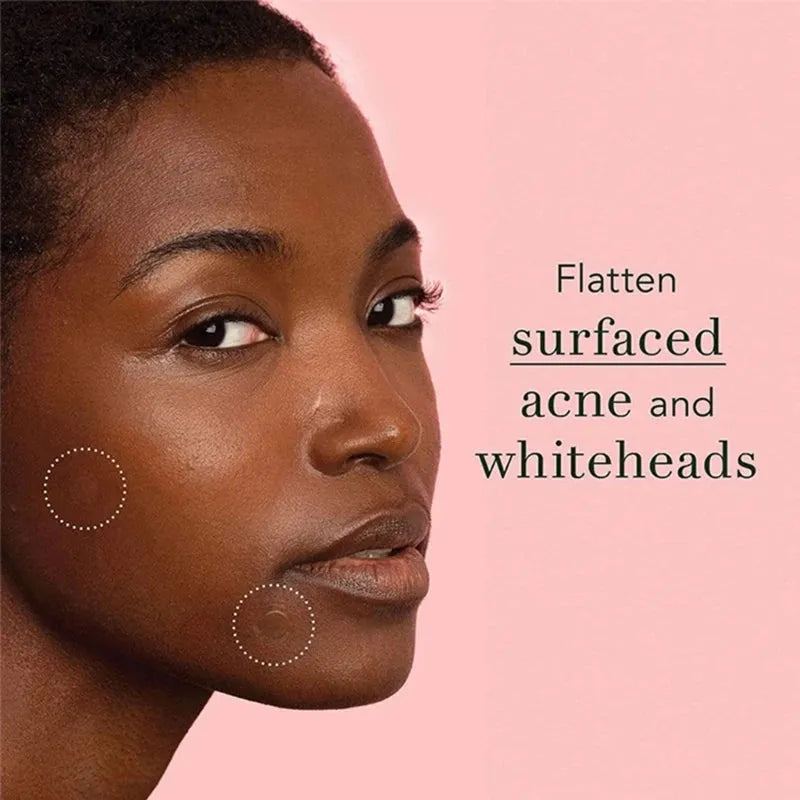 96Pcs/set Face Patch Hydrocolloid Acne Pimple Patches for Covering Zits & Blemishes, Thin Spot Stickers for Face & Skin