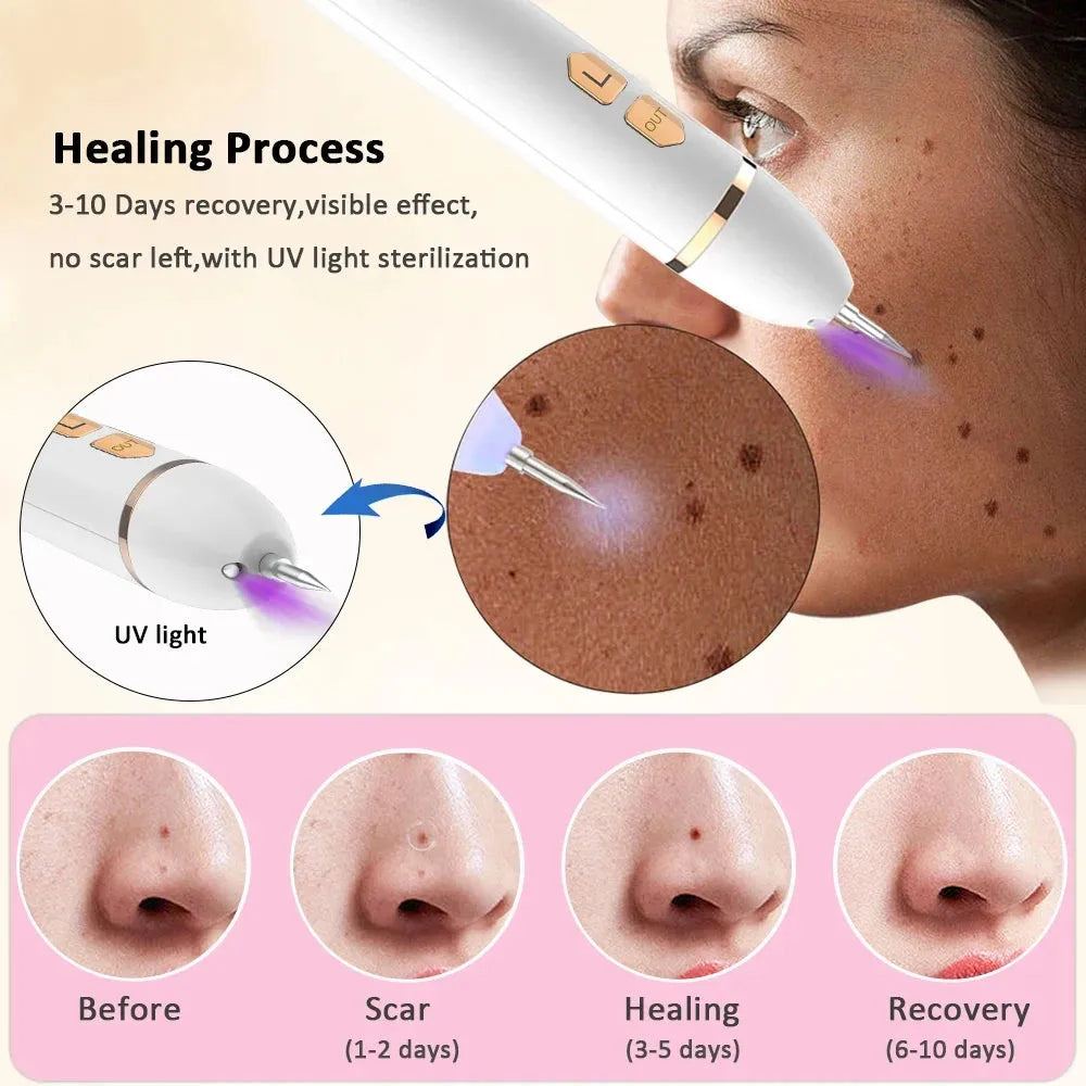 Plasma Laser Pen Skin Tag Remover Wart Mole Spots Freckles Dark Dpot Black Dots Nevus Flat Blemish Pimples Wart Eliminator