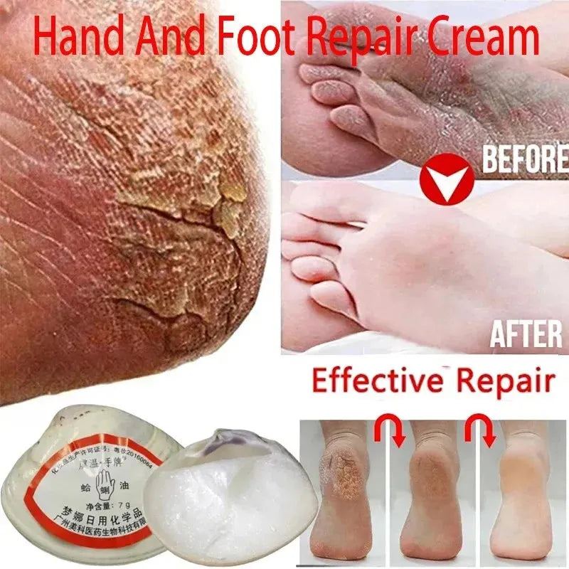 Traditional Chinese Clam Oil Cracked Repair Cream Anti-Drying Removal Dead Skin Hand Feet Foot Moisturize Care Oil Care Ointment