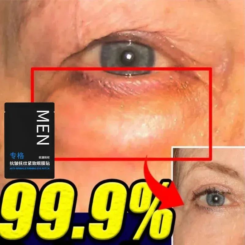 Eyes Bag Remove Collagen Eye Patch Instant Fade Fine Lines Dark Circles Fat Particles Moisturizing Anti-Puffiness Korea Eye Care