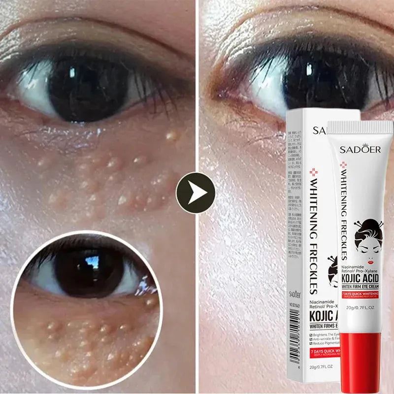 Fat Granules Remover Eye Cream Anti-Puffiness Firm Cream Anti Inflammatory Fade Fine Line Repair Skin Barrier Korean Skin Care