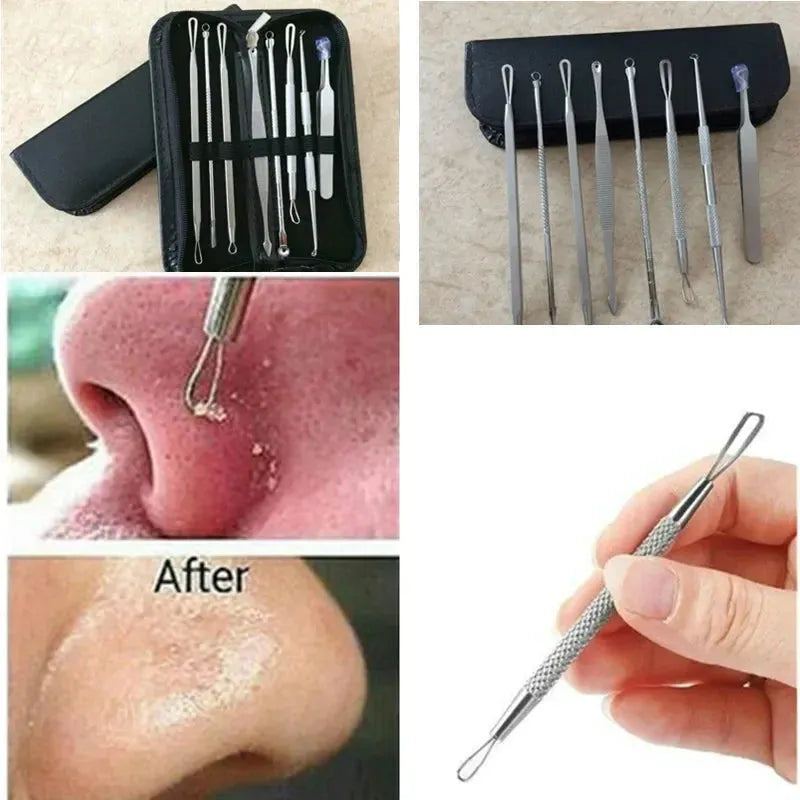 7/8Pcs Stainless Steel Blackhead Remover Tool Set Whitehead Pimple Spot Comedone Acne Extractor Remover Popper Face Tools Kit