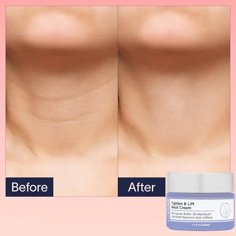 goPure Neck Firming Cream Anti-Aging Neck Cream for Tightening and Wrinkles Improve Dark Neck Skin Skincare 2024 Hot Selling