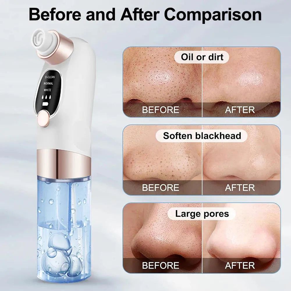 Electric Blackhead Remover Pore Vacuum Cleaner Facial Black Dots Vacuum Cleaner Pimple Acne Blackhead Removal Black Dots Remover